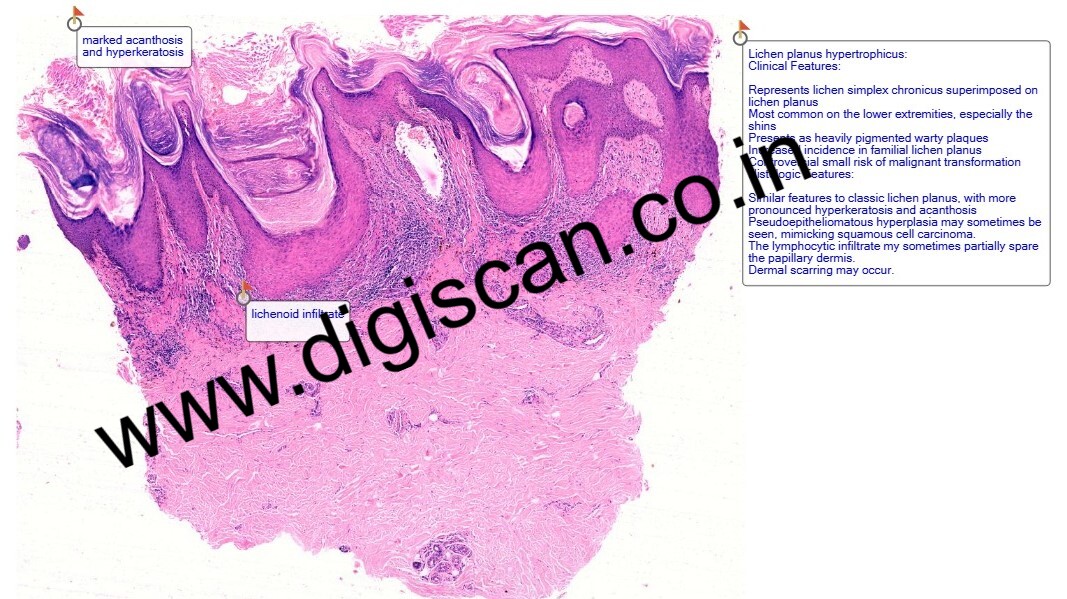 Dermatopathology Digital Slides Set (Skin Lesions, Infections & Tumors)